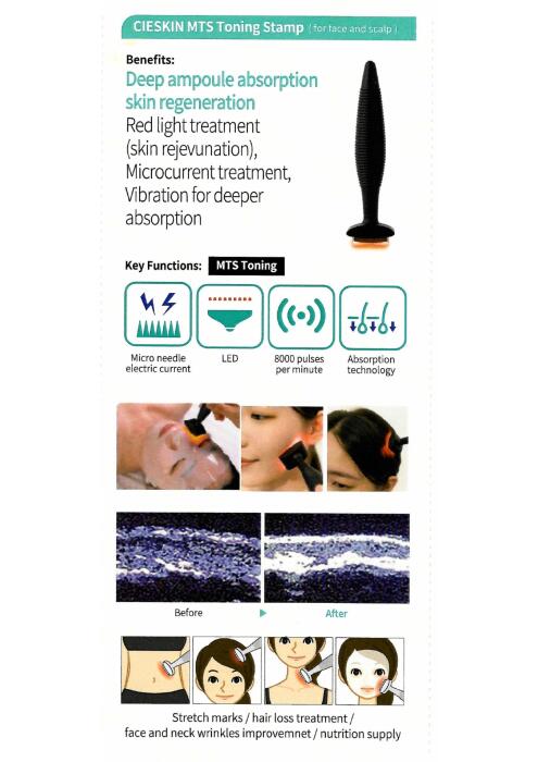 أم تي اس توننق ستامب (LED) image 12